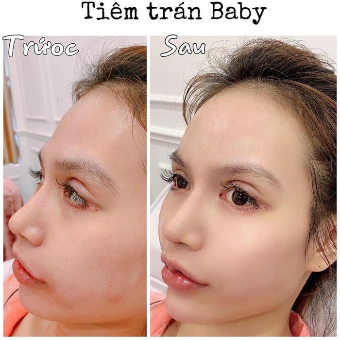 Không gian sang trọng tại JuJu Nguyễn Beauty - Nơi kiến tạo nét đẹp tinh tế