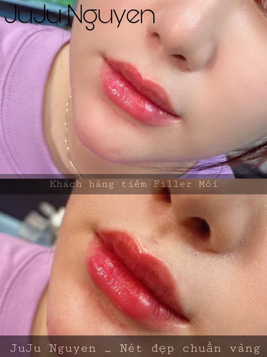 Hình ảnh quy trình làm đẹp chuyên nghiệp tại JuJu Nguyễn Beauty