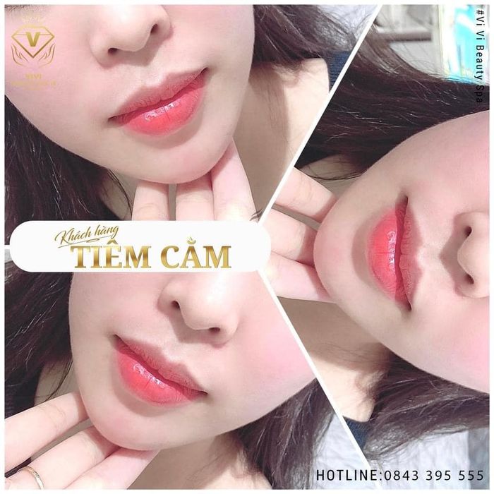 Không gian sang trọng đạt chuẩn 5 sao tại Thẩm Mỹ Viện Quốc Tế ViVi