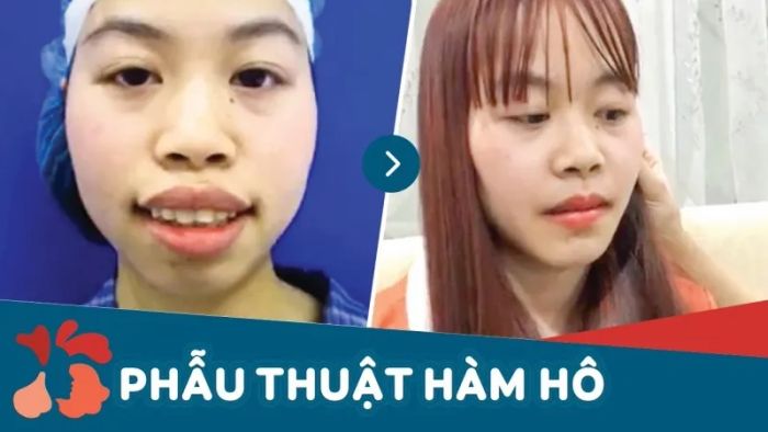 Hình ảnh Bệnh viện thẩm mỹ Kangnam - Địa chỉ vàng chỉnh hình hàm hô