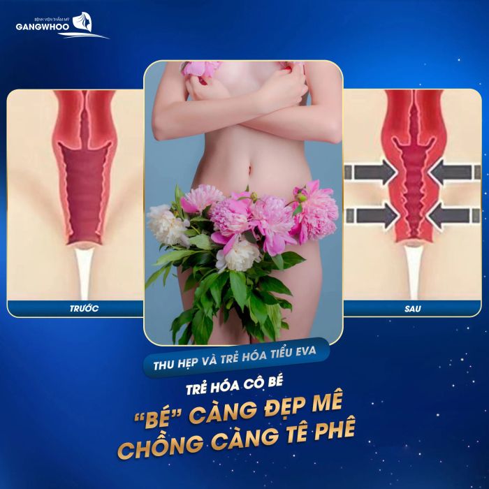 Hình ảnh quy trình thẩm mỹ chuẩn Hàn tại Gangwhoo