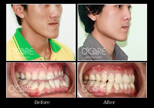 Hình ảnh 1 về Nha Khoa O'CARE - Không gian hiện đại, phòng phẫu thuật vô trùng đạt chuẩn và đội ngũ y bác sĩ giàu kinh nghiệm.