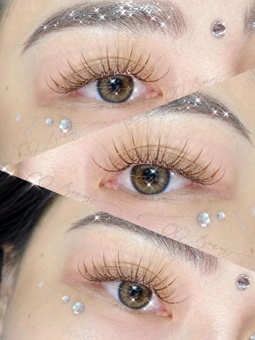 Hình ảnh 3 về Nha khoa Kim - Ghi lại những thành công trong các ca phẫu thuật hàm phức tạp với kết quả vượt mong đợi.