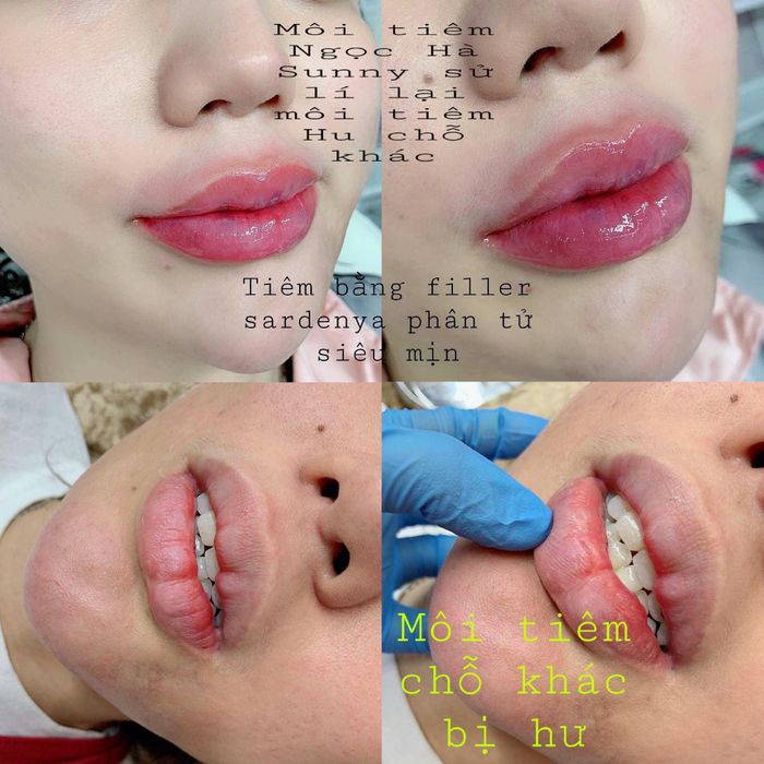 Phòng tiêm filler hiện đại chuẩn Hàn Quốc tại Ngọc Hà Sunny