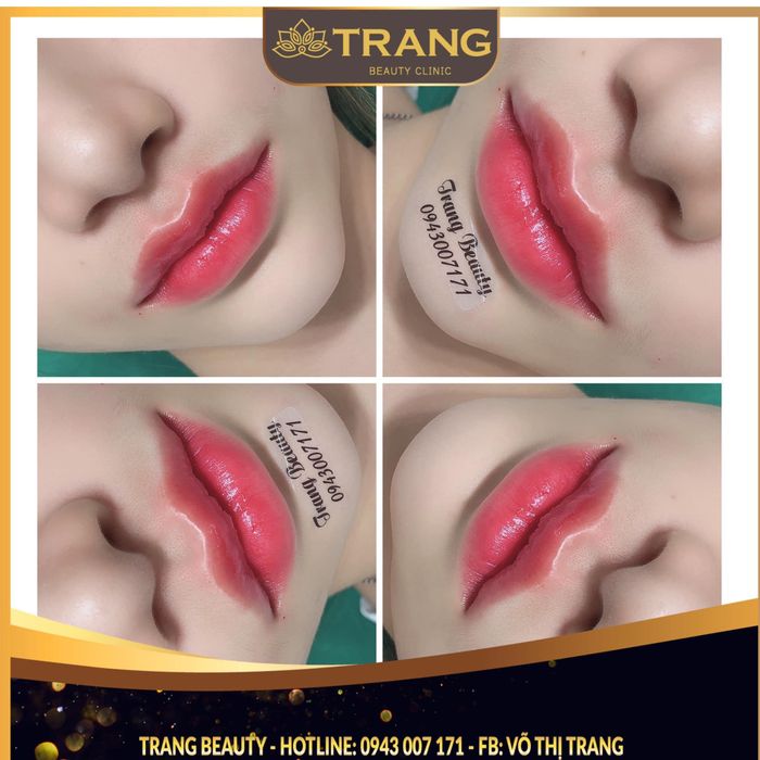 Không gian sang trọng đạt chuẩn y khoa tại Trang Beauty Clinic