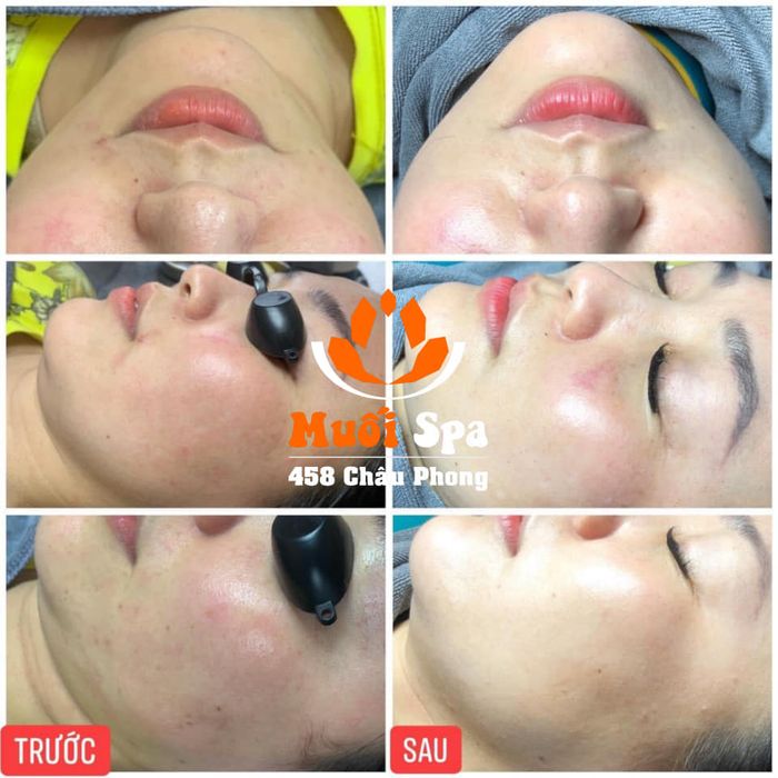 Hình ảnh liệu trình chăm sóc da cao cấp tại Muối Spa