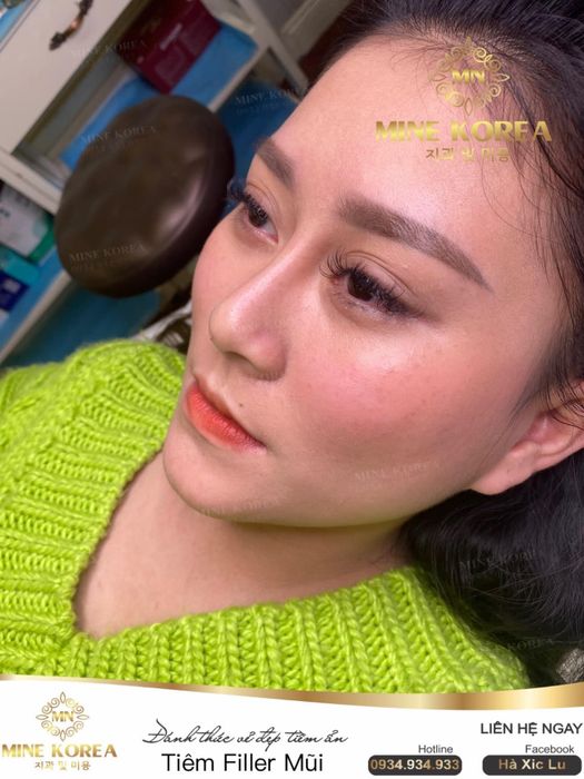 Cơ sở vật chất hiện đại tại Viện Thẩm Mỹ Quốc Tế MINE KOREA