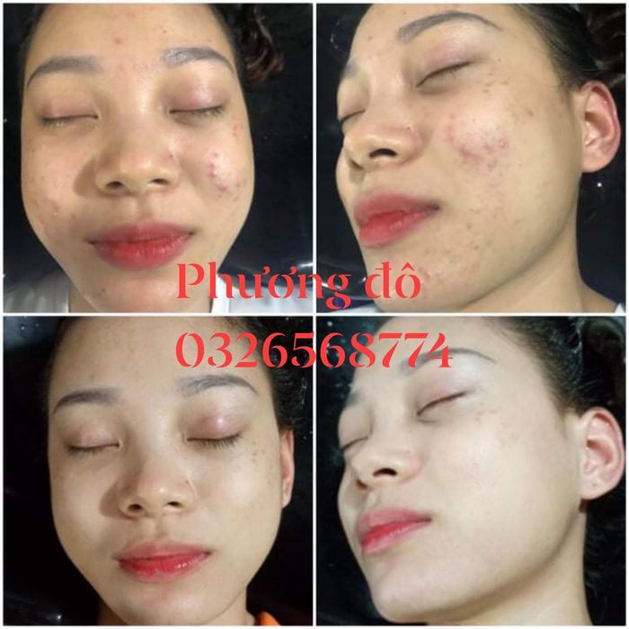 Hình ảnh liệu trình chăm sóc da cao cấp tại Phương Đô Spa
