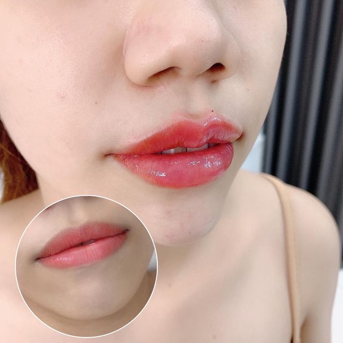 Phòng tiêm chuẩn y khoa tại Huyền Beauty