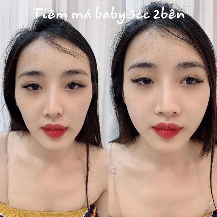 Hình ảnh quy trình chăm sóc da chuyên nghiệp tại spa
