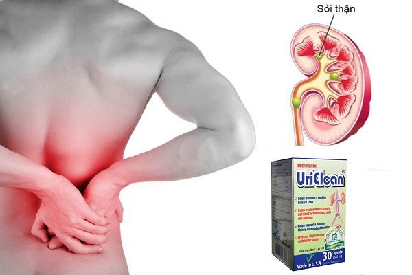 Hình ảnh sản phẩm Super Power Uriclean phiên bản 1