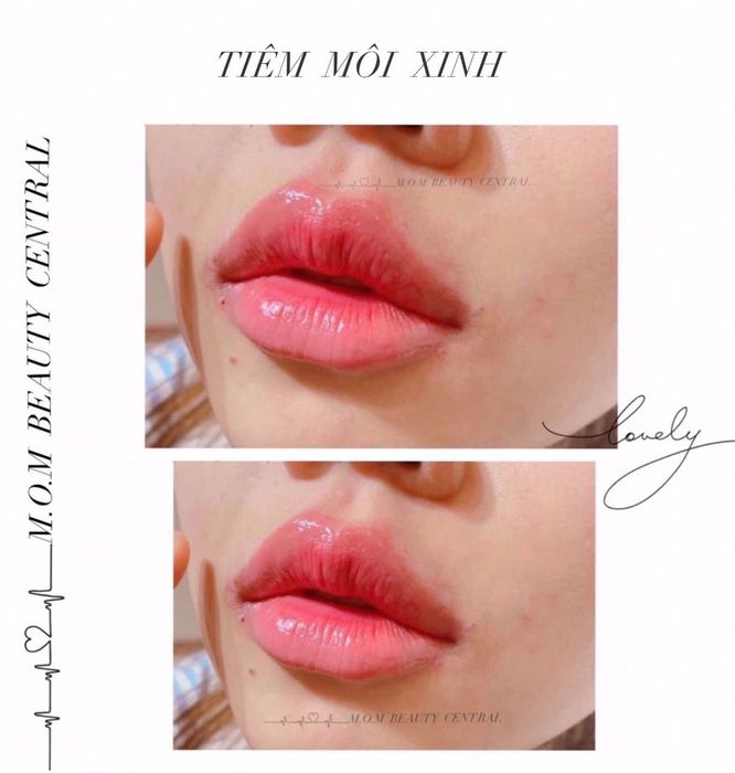 Không gian sang trọng tại Móm Beauty Central