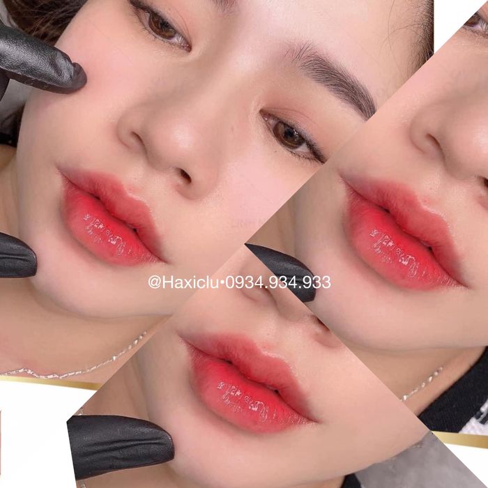 Phòng tiêm filler cao cấp tại Viện Thẩm Mỹ Quốc Tế MINE KOREA