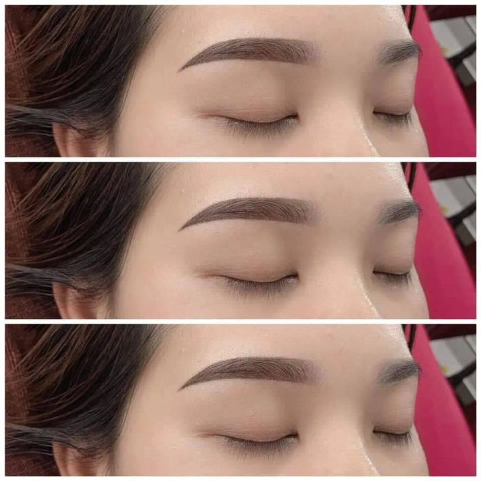 Hình ảnh trải nghiệm dịch vụ cao cấp tại Thẩm Mỹ Linh Anh