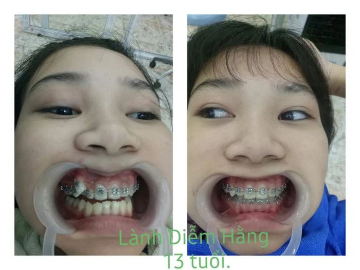 Hệ thống trang thiết bị hiện đại tại Phòng Khám Nha Khoa Quân Y