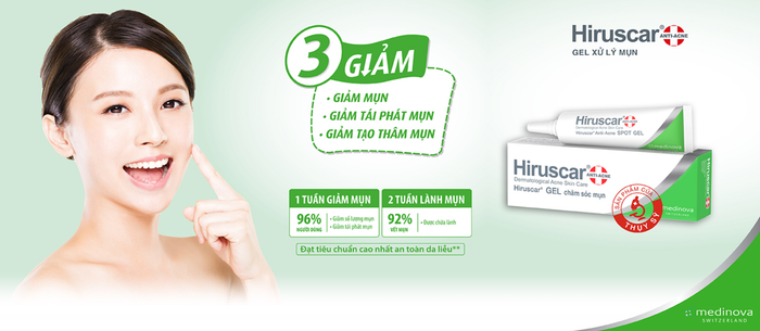 Hình ảnh thực tế Hiruscar - Thiết kế sang trọng, tiện dụng