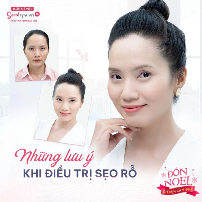 Hệ thống máy móc hiện đại nhập khẩu tại SeoulSpa.Vn