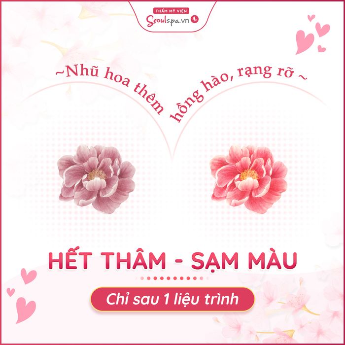 Thẩm Mỹ Viện SeoulSpa.Vn Huế hình ảnh 2