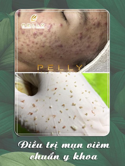 Không gian trị liệu hiện đại tại Pelly Spa Trảng Bàng