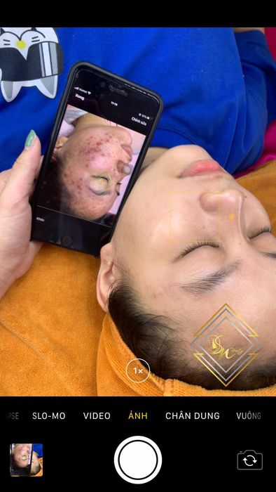 Quy trình chăm sóc da chuyên nghiệp tại Song Ngân Beauty Spa