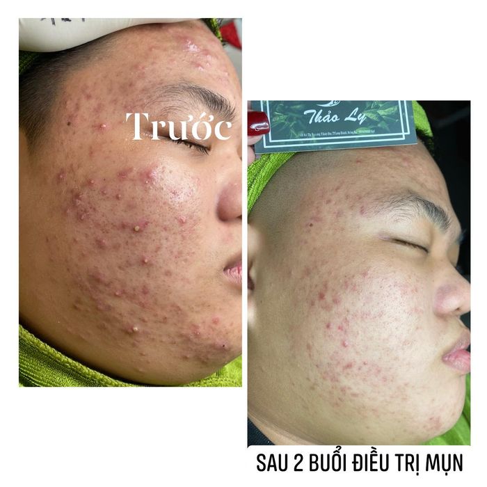 Spa Thảo Ly - Hình ảnh 1: Không gian sang trọng với hệ thống máy móc hiện đại