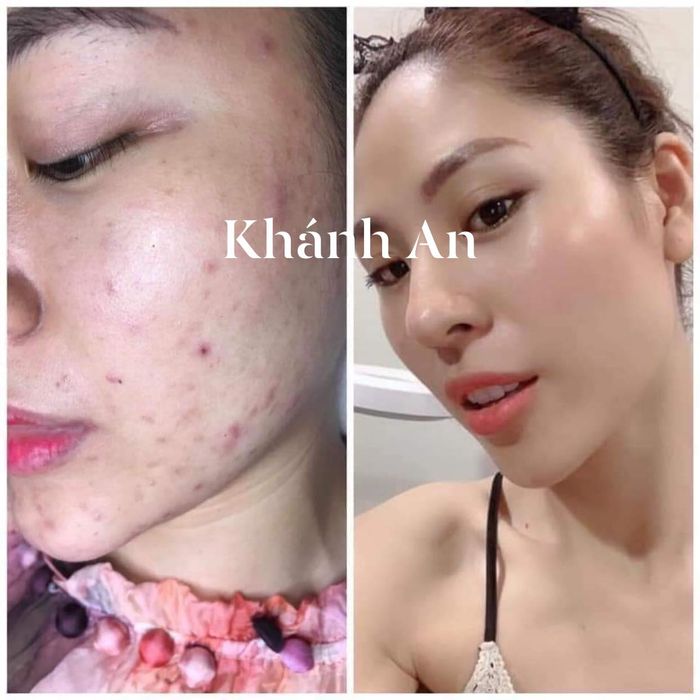 Anna Spa & Clinic - Hình ảnh 1: Không gian trị liệu đẳng cấp với công nghệ hiện đại