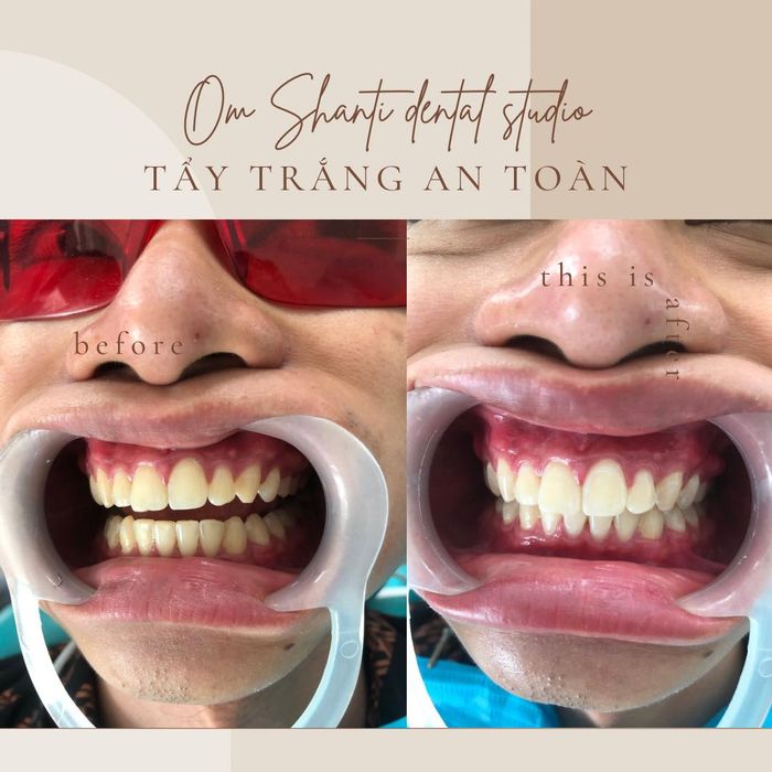 Nha Khoa Thẩm Mỹ OmShanti hình ảnh 3