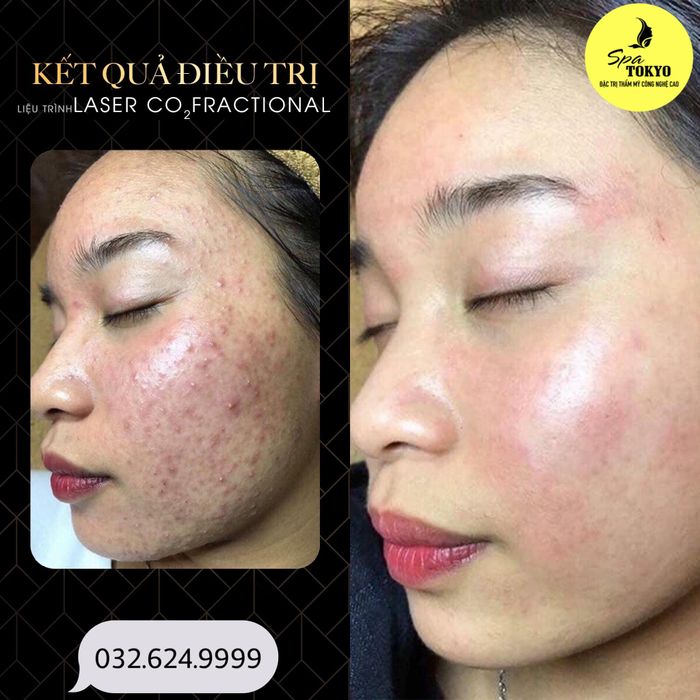 Ảnh 1 - Không gian thư giãn đẳng cấp tại Spa Tokyo