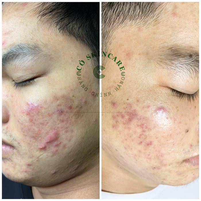 Cỏ Spa - Hình ảnh 2: Quy trình trị liệu chuyên nghiệp với công nghệ hàng đầu