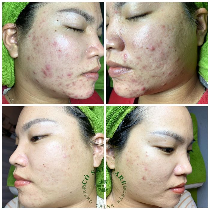 Cỏ Spa - Hình ảnh 1: Không gian sang trọng với hệ thống máy móc trị liệu da hiện đại
