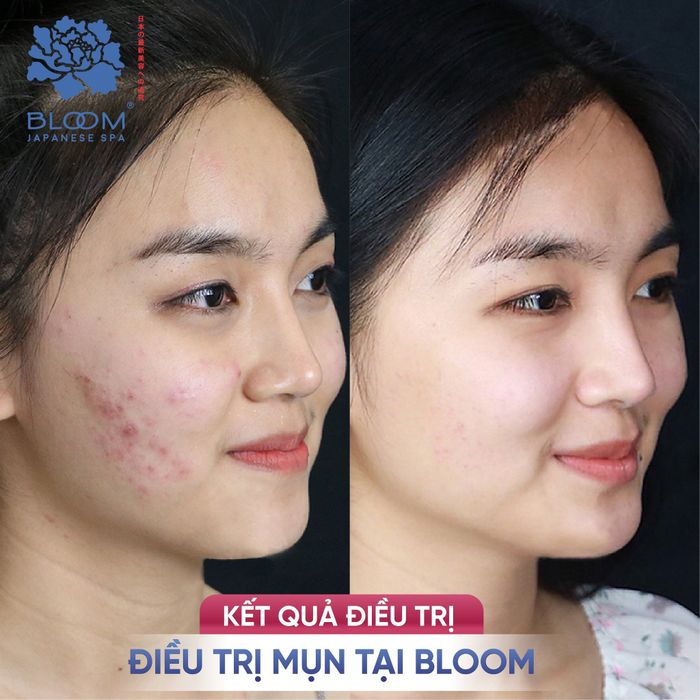 Không gian sang trọng và dịch vụ chuyên nghiệp tại Bloom Spa & Clinic Bắc Giang