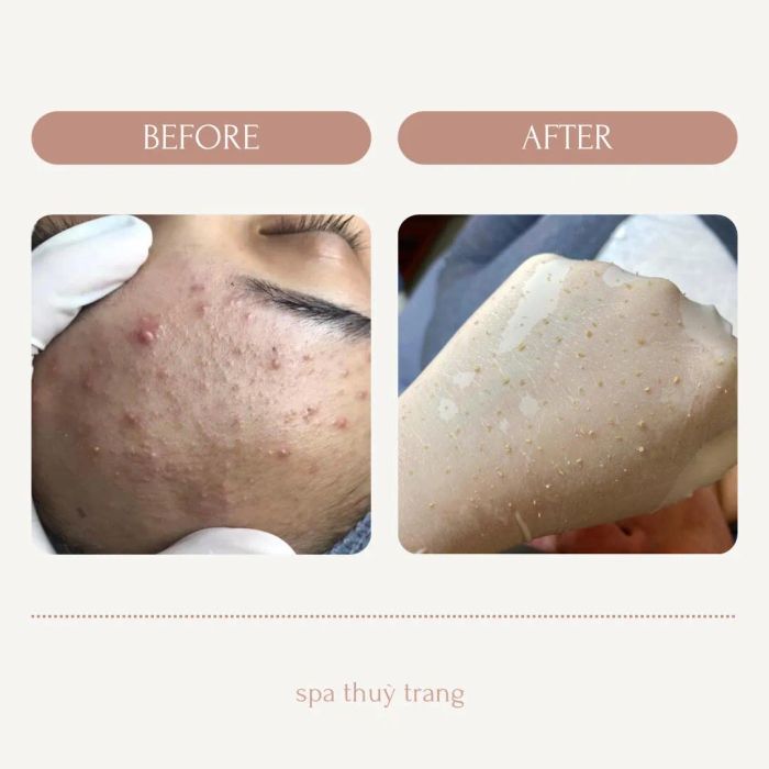 Hình ảnh không gian điều trị chuyên nghiệp tại Trang Beauty Center