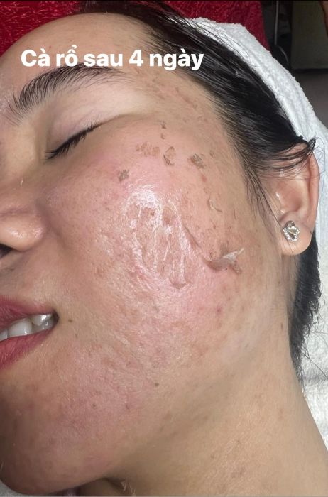 Hình ảnh không gian điều trị chuyên nghiệp tại Thẩm mỹ Ngọc Hằng