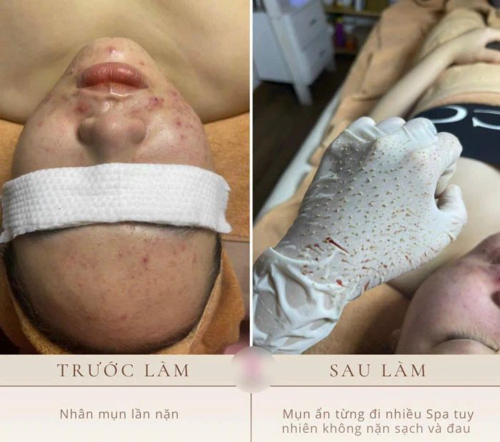 Hình ảnh liệu trình chăm sóc da chuyên nghiệp tại Bông Spa