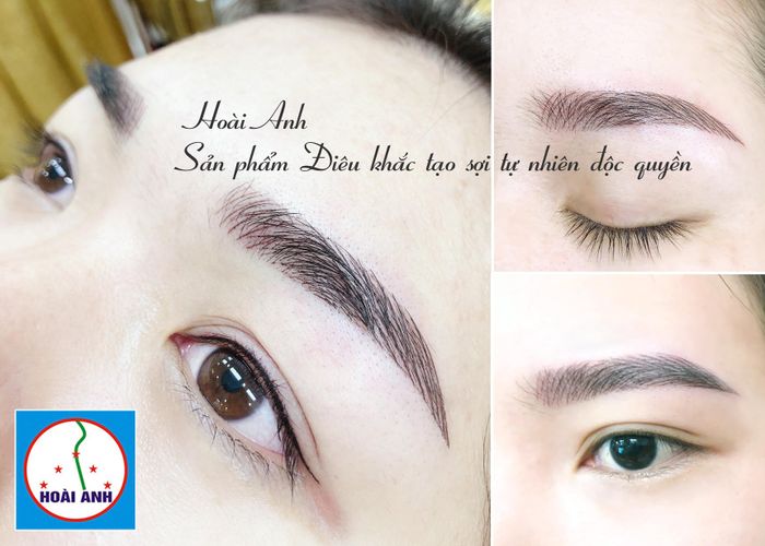 Thẩm Mỹ Viện Hoài Anh - Khoảnh khắc tỏa sáng qua ống kính (Ảnh 2)