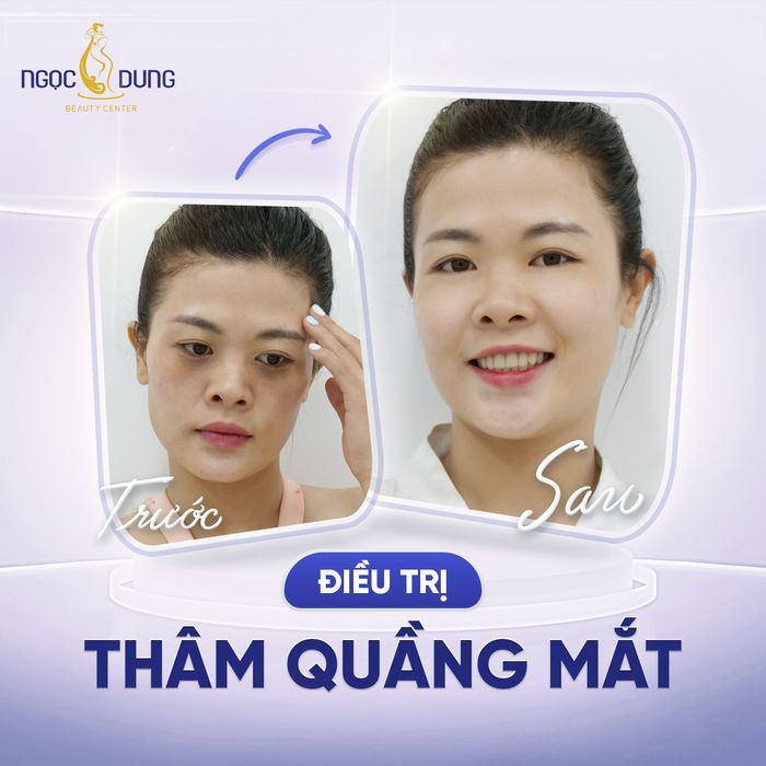 Thẩm Mỹ Viện Ngọc Dung Biên Hòa - Khoảnh khắc tỏa sáng (Ảnh 2)