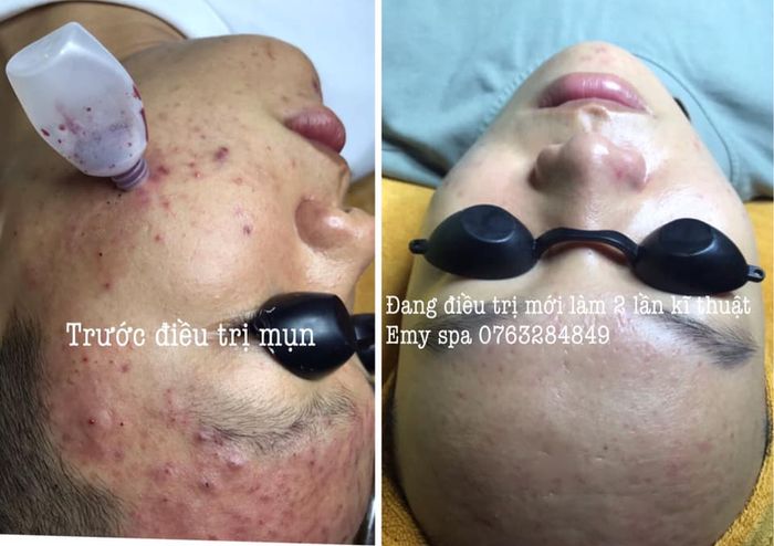 Emy Spa - Hình ảnh 2: Quy trình trị liệu chuyên nghiệp và đội ngũ tận tâm
