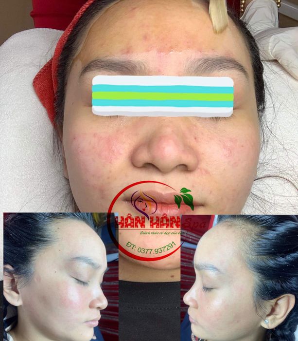 Hân Hân Spa - Hình ảnh 1: Không gian sang trọng với hệ thống máy móc hiện đại