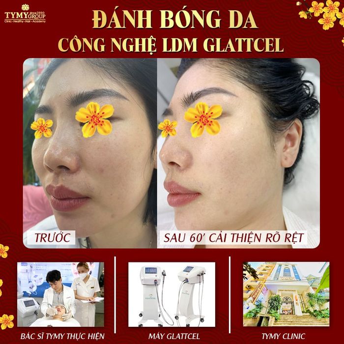 TyMy Spa & Beauty Salon - Trải nghiệm dịch vụ cao cấp