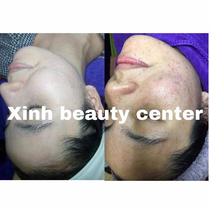 Hình ảnh thực tế về không gian trị liệu tại Xinh Beauty Center