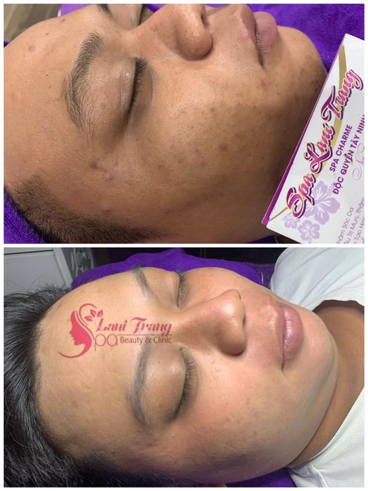 Hình ảnh thực tế về quy trình trị liệu tại Spa Lani Trang