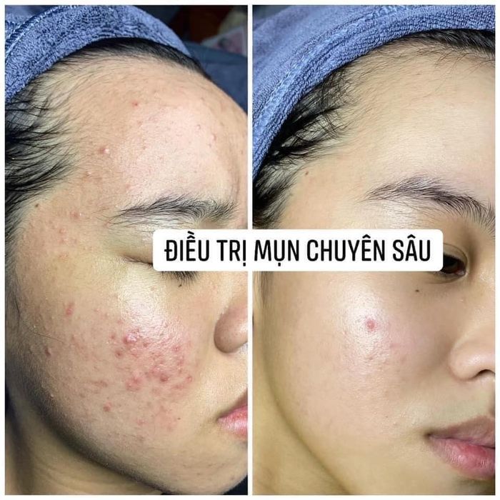 Alana Spa - Hình ảnh 1: Không gian sang trọng với phòng trị liệu tiêu chuẩn 5 sao