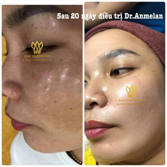 MiRe Home Spa - Kim Thiên Hoa - Không gian thư giãn đẳng cấp