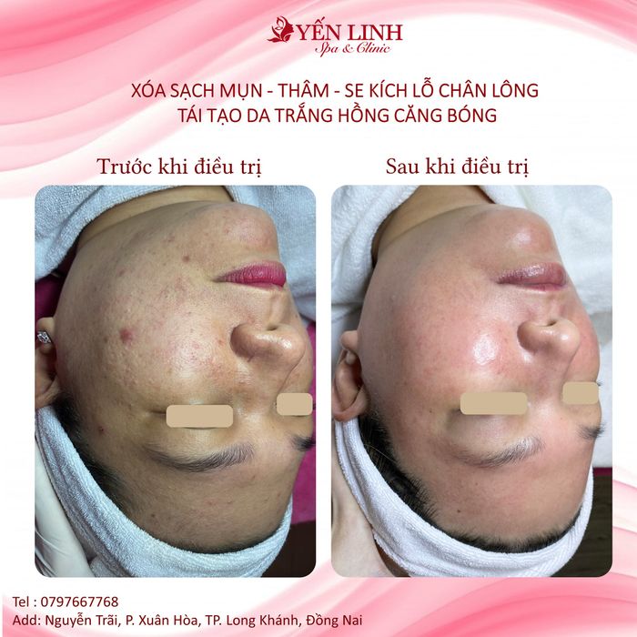Yến Linh Spa Clinic - Hình ảnh 2: Quy trình chăm sóc da chuyên nghiệp với công nghệ tiên tiến