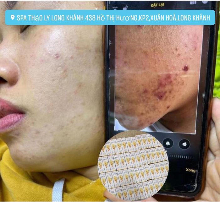 Spa Thảo Ly - Hình ảnh 2: Quy trình trị liệu chuyên nghiệp với công nghệ tiên tiến