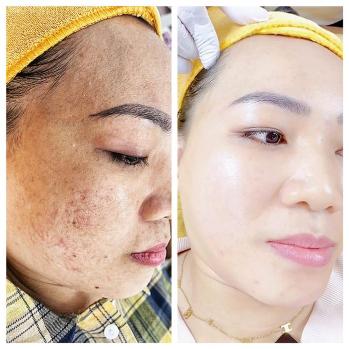 Thẩm Mỹ Viện Trang Hana - Tác phẩm nghệ thuật làm đẹp (Ảnh 1)