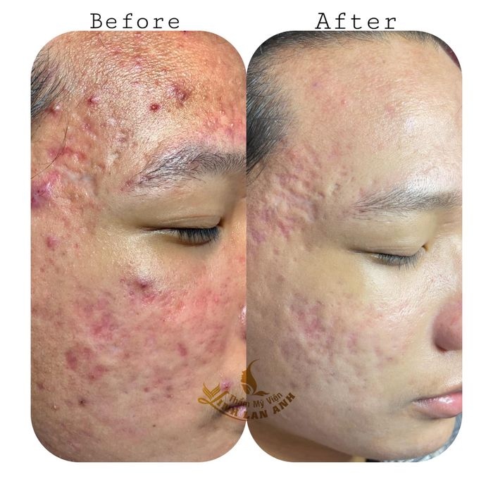 Thẩm Mỹ Viện Linh Lan Anh - Nét đẹp tỏa sáng (Ảnh 1)