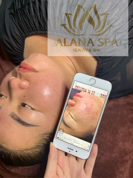 Alana Spa - Hình ảnh 2: Quy trình chăm sóc da chuyên nghiệp với công nghệ hiện đại