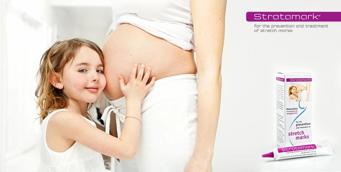 Hình ảnh minh họa sản phẩm kem rạn da Stratamark – sự lựa chọn tin cậy của nhiều mẹ bầu.