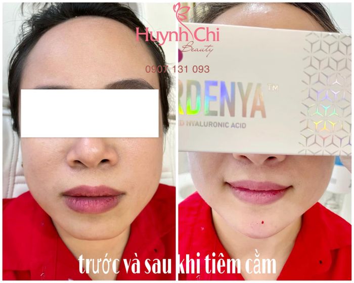 Hình ảnh Viện Thẩm Mỹ HUCI Beauty 2